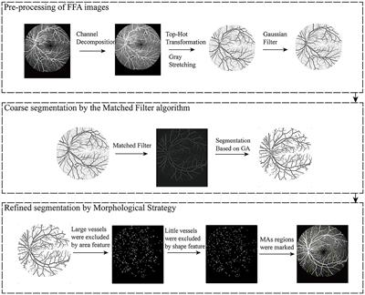 Segmentation of retinal microaneurysms in fluorescein fundus angiography images by a novel three-step model